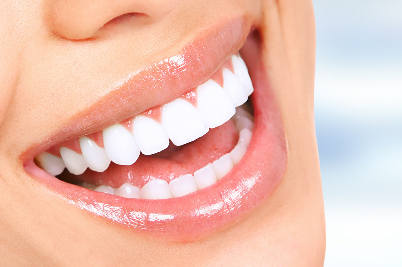 Cosmetic Dentistry in Wasilla